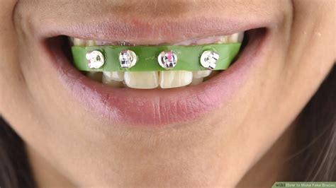 Make a Fashion Statement this Halloween with Colored Braces Texas