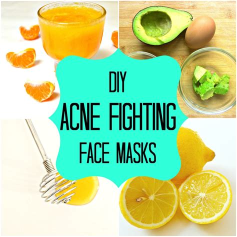 Homemade Face Mask For Acne Treatment At Home!