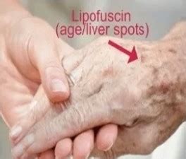 Dmae Lipofuscin
