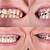 do crooked teeth get worse with age