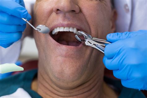 Why Do Dentists take Dental XRays?