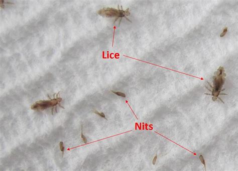 Do All Nits Lay Eggs