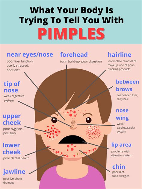 Do Antioxidants Cause Pimples