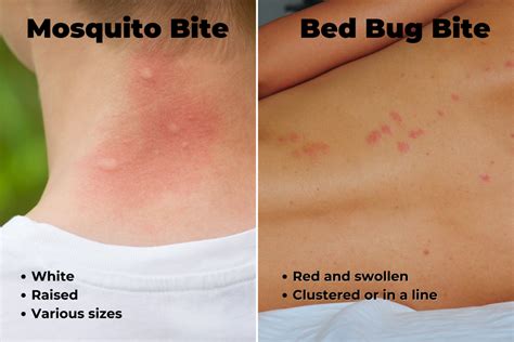 Do Bed Bugs Leave Puncture Marks