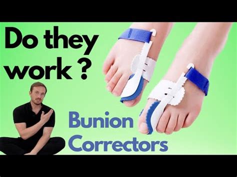 Do Bunion Toe Straighteners Work