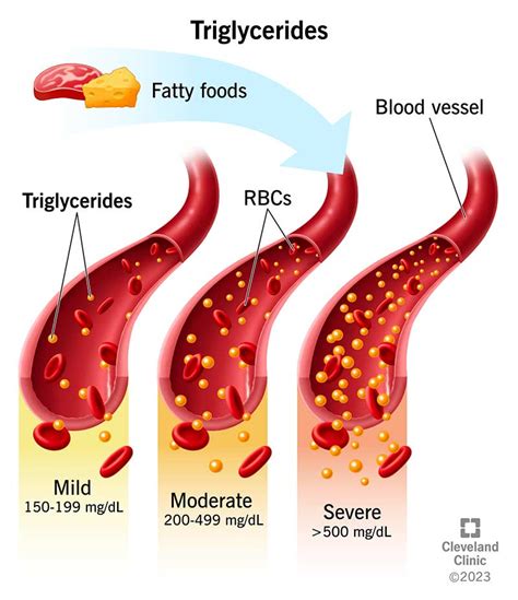 Do Carbohydrates Increase Triglycerides