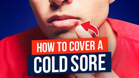 Do Cold Sore Covers Work
