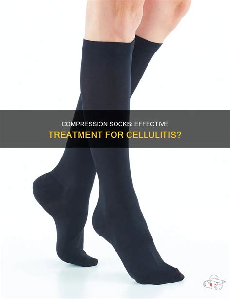 Do Compression Socks Help Cellulitis
