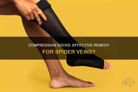Do Compression Socks Help Spider Veins