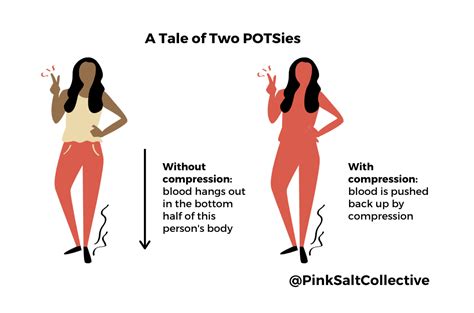 Do Compression Socks Help With Pots