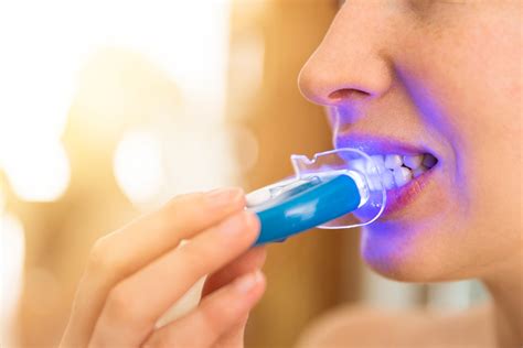 Teeth Whitening Kits Do they Really Work? Smile 360 Award Winning