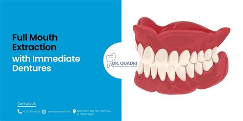 Dental Extractions Dr.Koya the dentist best dental clinic in