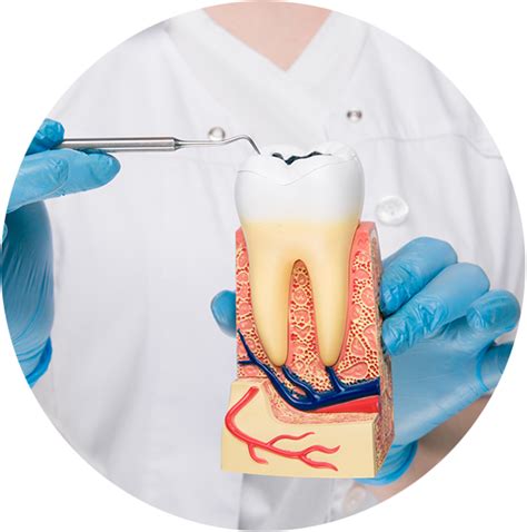 Internal Tooth Bleaching Procedure & Information MENYC