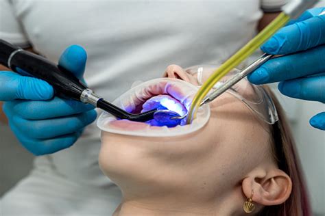 Dentist Using Ultraviolet Light Photograph by Science Photo Library
