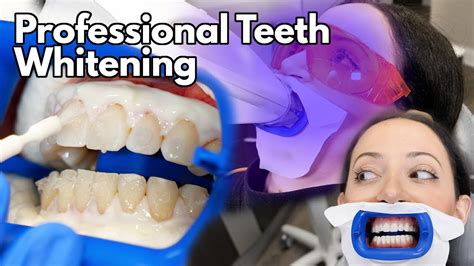Teeth Whitening Why is Professional consultation Important?Minneapolis