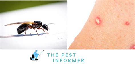 Do Flying Ants Bite? The Truth About These Tiny Pests