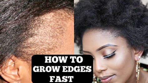 Do Hair Edges Grow Back  Tips And Faq