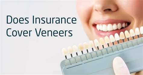 do health insurance cover veneers