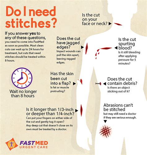 Do I Need Stitches? A Guide to Wound Care and When to Seek Medical Attention