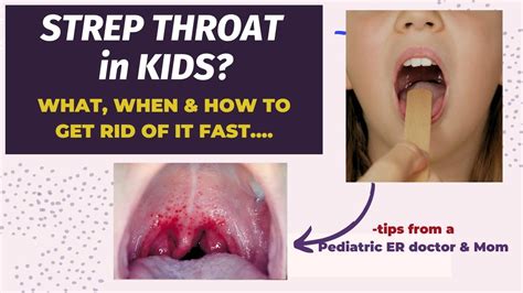 Do Infants Get Strep