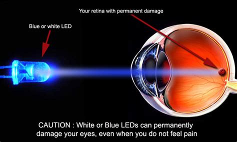 Do Led Lights Cause Eye Problems