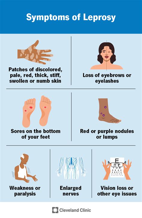 Do Lepers Still Exist