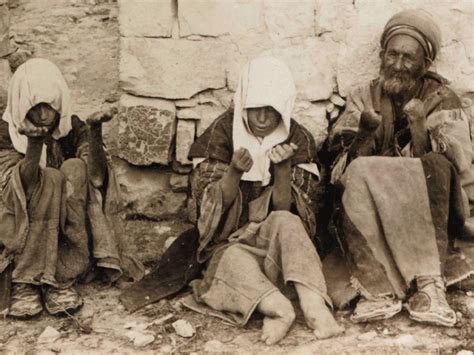 Do Leprosy Colonies Still Exist