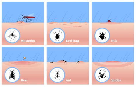 Do Mosquito Bites Spread