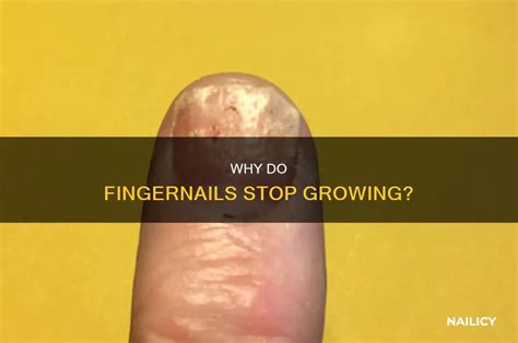 Do Nails Stop Growing