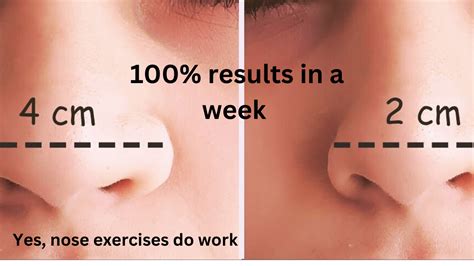 do nose exercises actually work