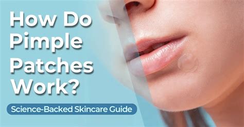 Do Pimple Patches Even Work