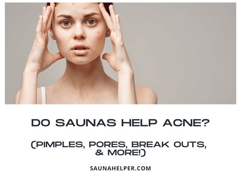 Do Saunas Help with Acne? The Truth Revealed