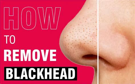 Do Scrub Remove Blackheads