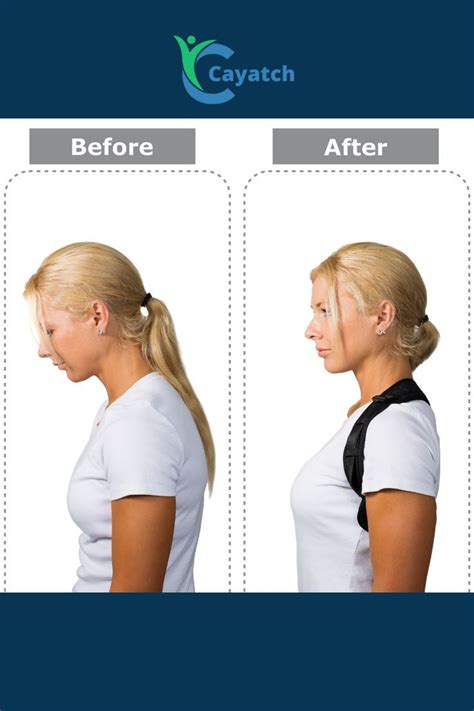 Do Spine Correctors Work