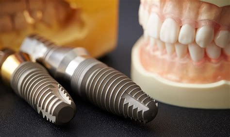 Do Titanium Implants Cause Cancer