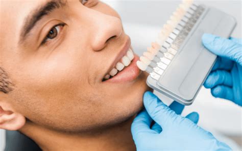Do Veneers Remove Enamel