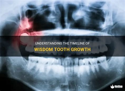 do wisdom teeth grow in