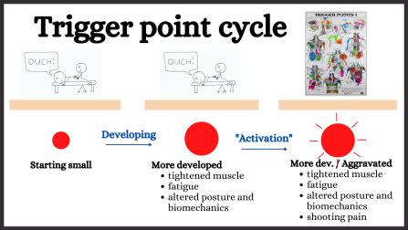 Do trigger points go away?