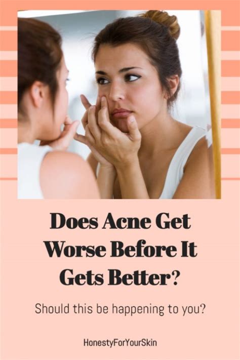 does acne get worse before it gets better