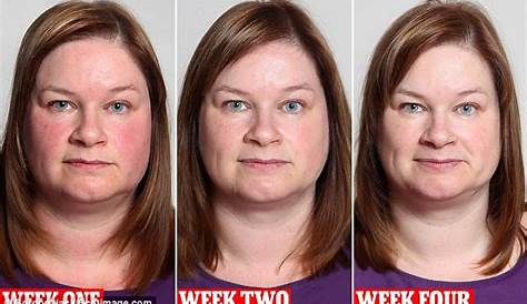 Does Alcohol Cause Chubby Cheeks Flush Reaction s Symptoms & Prevention