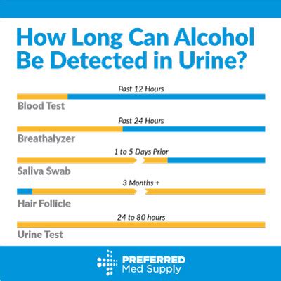 Urine alcohol tests How long can they detect drinking?