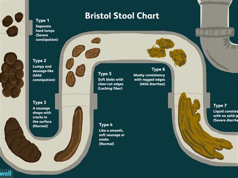The smaller bowel imaging the small bowel in paediatric Crohn's