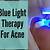 does blue light therapy work for cystic acne