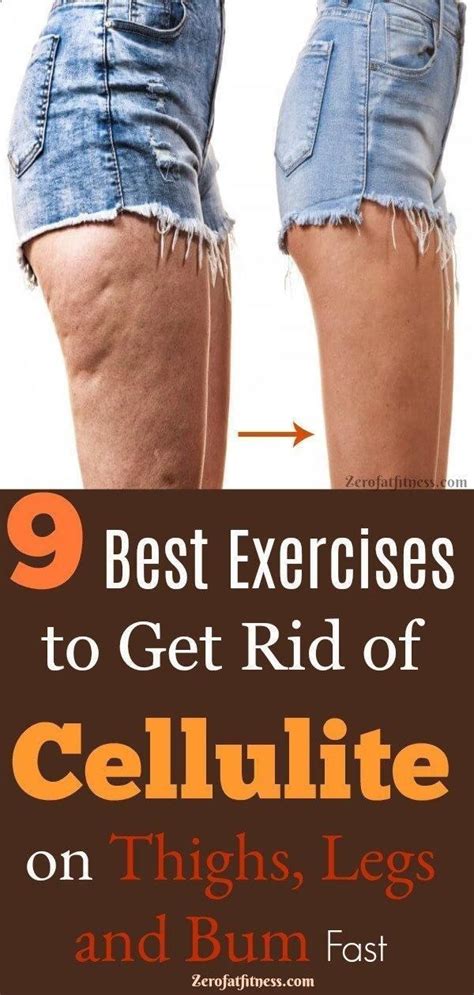 does exercise get rid of cellulite on legs