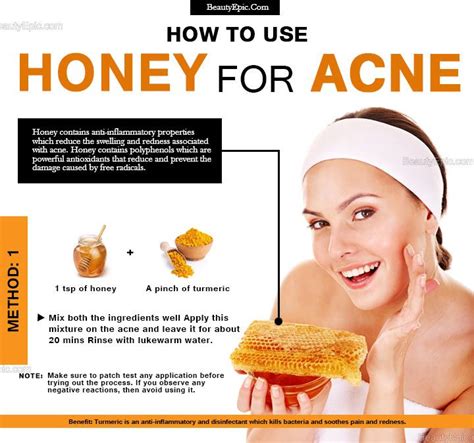 does honey help acne