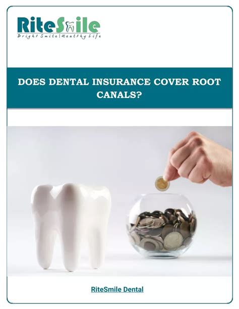 Does Insurance Cover Root Canal?