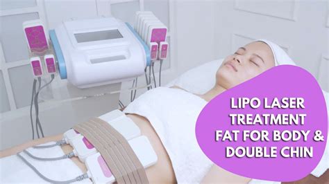 does laser lipo work on belly fat
