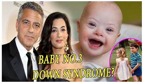 Unveiling The Truth Behind George Clooney's Twins And Down Syndrome: Exploring The Facts