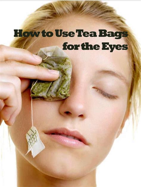 Does A Tea Bag Help A Black Eye
