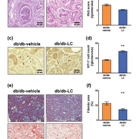 Does Acetyl L Carnitine Affect Kidneys